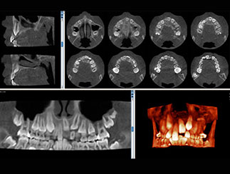 歯列矯正診断